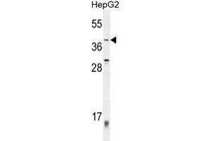 ZNF763 Antibody (C-term) western blot analysis in HepG2 cell line lysates (35 µg/lane). (ZNF763 抗体  (C-Term))