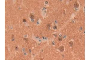 Immunohistochemistry (IHC) image for anti-Ubiquitin Carboxyl-terminal Esterase L1 (Ubiquitin Thiolesterase) (UCHL1) (AA 2-223) antibody (ABIN7436390)