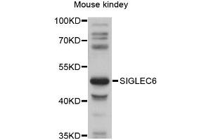 Western blot analysis of extracts of mouse kidney, using SIGLEC6 antibody (ABIN6292272) at 1:1000 dilution. (SIGLEC6 抗体)