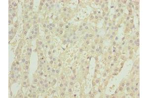 Immunohistochemistry of paraffin-embedded human adrenal gland tissue using ABIN7153761 at dilution of 1:100 (GEMIN6 抗体  (AA 1-167))