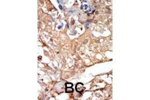 Immunohistochemistry (Paraffin-embedded Sections) (IHC (p)) image for anti-V-Raf-1 Murine Leukemia Viral Oncogene Homolog 1 (RAF1) (AA 1-30), (N-Term) antibody (ABIN392261)