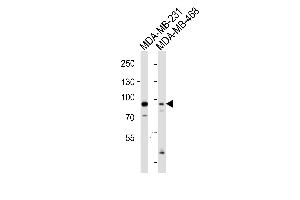 Western blot analysis of lysates from MDA-MB-231,MDA-MB-468 cell line (from left to right),using Cullin 1 Antibody (ABIN483861 and ABIN1533244). (Cullin 1 抗体)
