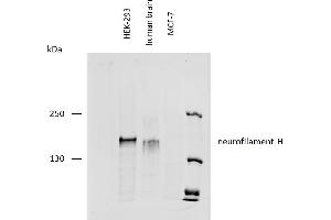 Western blotting analysis of human neurofilament H protein using mouse monoclonal antibody NF-01 on lysates of HEK-293 cell line, human brain lysate, and MCF-7 cell line (neurofilament non-expressing cell line, negative control) under reducing conditions. (NEFH 抗体)