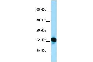 Host: Rabbit Target Name: RPL18A Sample Type: Jurkat Whole Cell lysates Antibody Dilution: 1. (RPL18A 抗体  (C-Term))