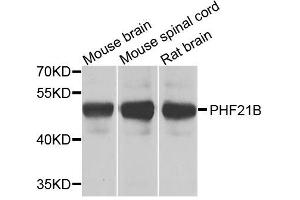 Western blot analysis of extracts of various cell lines, using PHF21B antibody. (PHF21B 抗体  (AA 322-531))