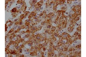 IHC image of ABIN7127355 diluted at 1:100 and staining in paraffin-embedded human liver tissue performed on a Leica BondTM system. (Recombinant ATP5B 抗体)