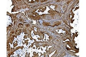 IHC analysis of PDIA5 using anti-PDIA5 antibody (ABIN7601801).