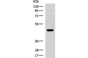 Western blot analysis of TM4 cell lysate using DNAJA4 Polyclonal Antibody at dilution of 1:800 (DNAJA4 抗体)