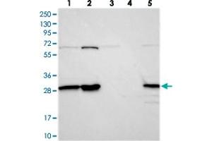 Western blot analysis of Lane 1: RT-4, Lane 2: U-251 MG, Lane 3: Human Plasma, Lane 4: Liver, Lane 5: Tonsil with INO80E polyclonal antibody  at 1:250-1:500 dilution. (INO80E 抗体)
