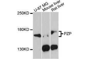 Western blot analysis of extracts of various cell lines, using PZP antibody (ABIN5971715) at 1:3000 dilution. (PZP 抗体)