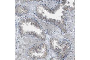 Immunohistochemical staining of human prostate with ZNF516 polyclonal antibody  shows granular cytoplasmic positivity in glandular cells. (ZNF516 抗体)
