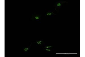 Immunofluorescence of monoclonal antibody to NR1D1 on HeLa cell. (NR1D1 抗体  (AA 233-322))
