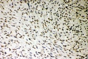 IHC analysis of SMURF1 using anti-SMURF1 antibody (ABIN3044547).