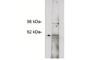 Image no. 1 for anti-Notum Pectinacetylesterase Homolog (NOTUM) antibody (ABIN265168) (NOTUM 抗体)