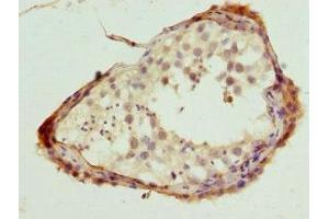 Immunohistochemistry of paraffin-embedded human testis tissue using ABIN7169125 at dilution of 1:100 (Nemo-Like Kinase 抗体  (AA 278-527))
