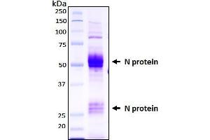 SDS-PAGE (SDS) image for SARS-CoV-2 Nucleocapsid (SARS-CoV-2 N) (AA 1-419) protein (His tag) (ABIN6952469)