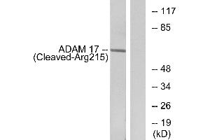 Western blot analysis of extracts from rat liver cells, using ADAM 17 (Cleaved-Arg215) antibody. (ADAM17 抗体  (Cleaved-Arg215))