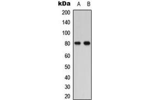Western blot analysis of PTHR1 expression in HEK293T (A), COLO205 (B) whole cell lysates. (PTH1R 抗体  (Center))