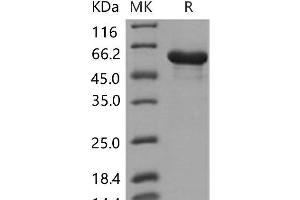Heat Shock 60kDa Protein 1 (Chaperonin) (HSPD1) protein (His tag)