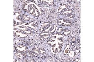 IHC analysis of CD47 using anti-CD47 antibody (ABIN6719291).