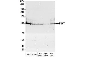 Western Blotting (WB) image for anti-Protein-L-Isoaspartate (D-Aspartate) O-Methyltransferase (PCMT1) (AA 150-200) antibody (ABIN7453899)