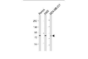 All lanes : Anti-TLR2 Antibody at 1:500-1:1000 dilution Lane 1: Ramos whole cell lysate Lane 2: A549 whole cell lysate Lane 3: MDA-MB-231 whole cell lysate Lysates/proteins at 20 μg per lane. (TLR2 抗体)