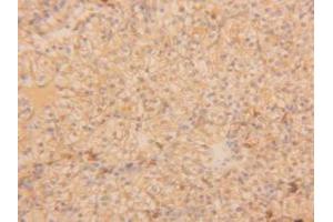 Figure. (TPSAB1 抗体  (AA 161-262))