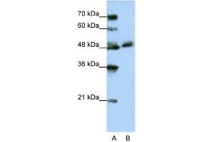 WB Suggested Anti-WDR13 Antibody Titration:  1. (WDR13 抗体  (N-Term))