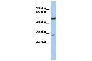 WB Suggested Anti-PHOX2A Antibody Titration:  0. (PHOX2A 抗体  (N-Term))