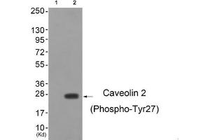 Western blot analysis of extracts from cos-7 cells (Lane 2), using Caveolin 2 (Phospho-Tyr27) Antibody. (Caveolin 2 抗体  (pTyr27))