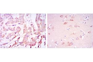 Immunohistochemistry (IHC) image for anti-3-phosphoinositide Dependent Protein Kinase-1 (PDPK1) antibody (ABIN969347)