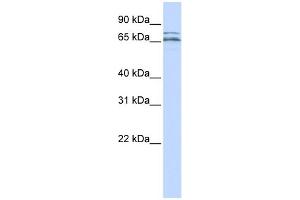 WB Suggested Anti-CACNB2 Antibody Titration:  0. (CACNB2 抗体  (Middle Region))