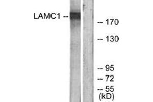 Western Blotting (WB) image for anti-Laminin, gamma 1 (LAMC1) (AA 1451-1500) antibody (ABIN2890005) (Laminin gamma 1 抗体  (AA 1451-1500))