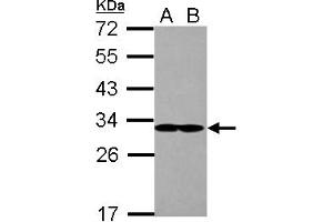 Image no. 2 for anti-Eukaryotic Translation Initiation Factor 2B, Subunit 1 Alpha, 26kDa (EIF2B1) (AA 1-305) antibody (ABIN1497966) (EIF2B1 抗体  (AA 1-305))
