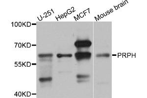 Western blot analysis of extracts of various cell lines, using PRPH antibody. (Peripherin 抗体)