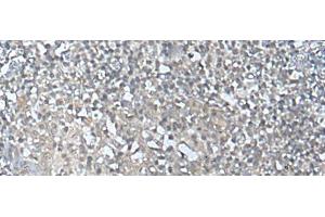 Immunohistochemistry of paraffin-embedded Human tonsil tissue using MEF2D Polyclonal Antibody at dilution of 1:50(x200) (MEF2D 抗体)
