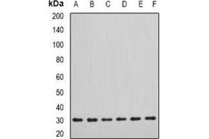 Western blot analysis of DDAH2 expression in SW620 (A), MCF7 (B), mouse lung (C), mouse kidney (D), rat heart (E), rat brain (F) whole cell lysates. (DDAH2 抗体)