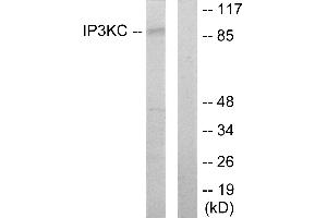 Western blot analysis of extracts from HT-29 cells, using IP3KC antibody. (ITPKC 抗体)