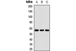 Western blot analysis of Cytokeratin 4 expression in HEK293T (A), Raw264. (KRT4 抗体  (Center))
