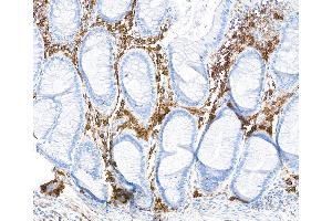 Immunohistochemistry (IHC) image for anti-CD38 (AA 43-300) antibody (ABIN7453961) (Recombinant CD38 抗体  (AA 43-300))