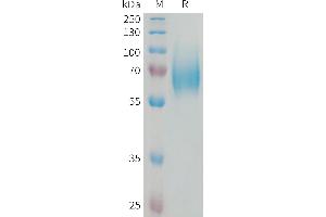 Human F Protein, His Tag on SDS-PAGE under reducing condition.