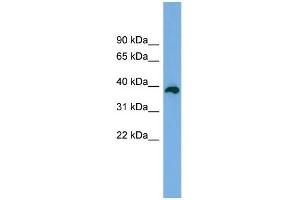 WB Suggested Anti-DEDD2 Antibody Titration: 0. (DEDD2 抗体  (Middle Region))
