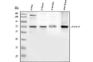 Western blot analysis of ATF2 using anti-ATF2 antibody (ABIN3043791). (ATF2 抗体  (AA 93-450))
