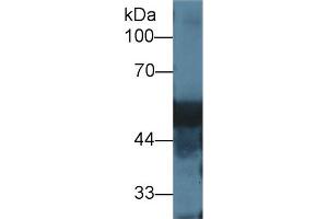 Western blot analysis of Rat Liver lysate, using Rat DBP Antibody (1 µg/ml) and HRP-conjugated Goat Anti-Rabbit antibody ( (Vitamin D-Binding Protein 抗体  (AA 395-475))