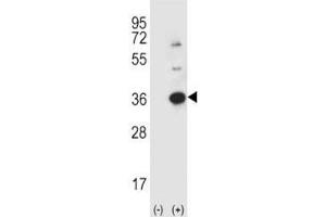 Western blot analysis using anti-Caspase-3 antibody and 293 cell lysate (2 ug/lane) either nontransfected (Lane 1) or transiently transfected (2) with the CASP3 gene. (Caspase 3 抗体  (AA 60-90))