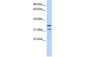 C17ORF81 antibody used at 1 ug/ml to detect target protein. (Retinoic Acid Induced 12 (RAI12) (Middle Region) 抗体)