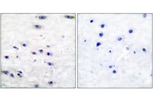 Immunohistochemistry analysis of paraffin-embedded human brain tissue, using Tyrosine Hydroxylase (Ab-19) Antibody. (Tyrosine Hydroxylase 抗体  (AA 10-59))