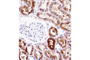 PDZK1 Antibody immunohistochemistry analysis in formalin fixed and paraffin embedded human kidney tissue followed by peroxidase conjugation of the secondary antibody and DAB staining. (PDZK1 抗体  (AA 196-224))