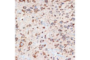 Immunohistochemistry of paraffin-embedded mouse spinal cord using  Rabbit mAb (ABIN7265453) at dilution of 1:100 (40x lens). (ADORA1 抗体)