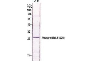 Western Blot (WB) analysis of specific cells using Phospho-Bcl-2 (S70) Polyclonal Antibody. (Bcl-2 抗体  (pSer70))